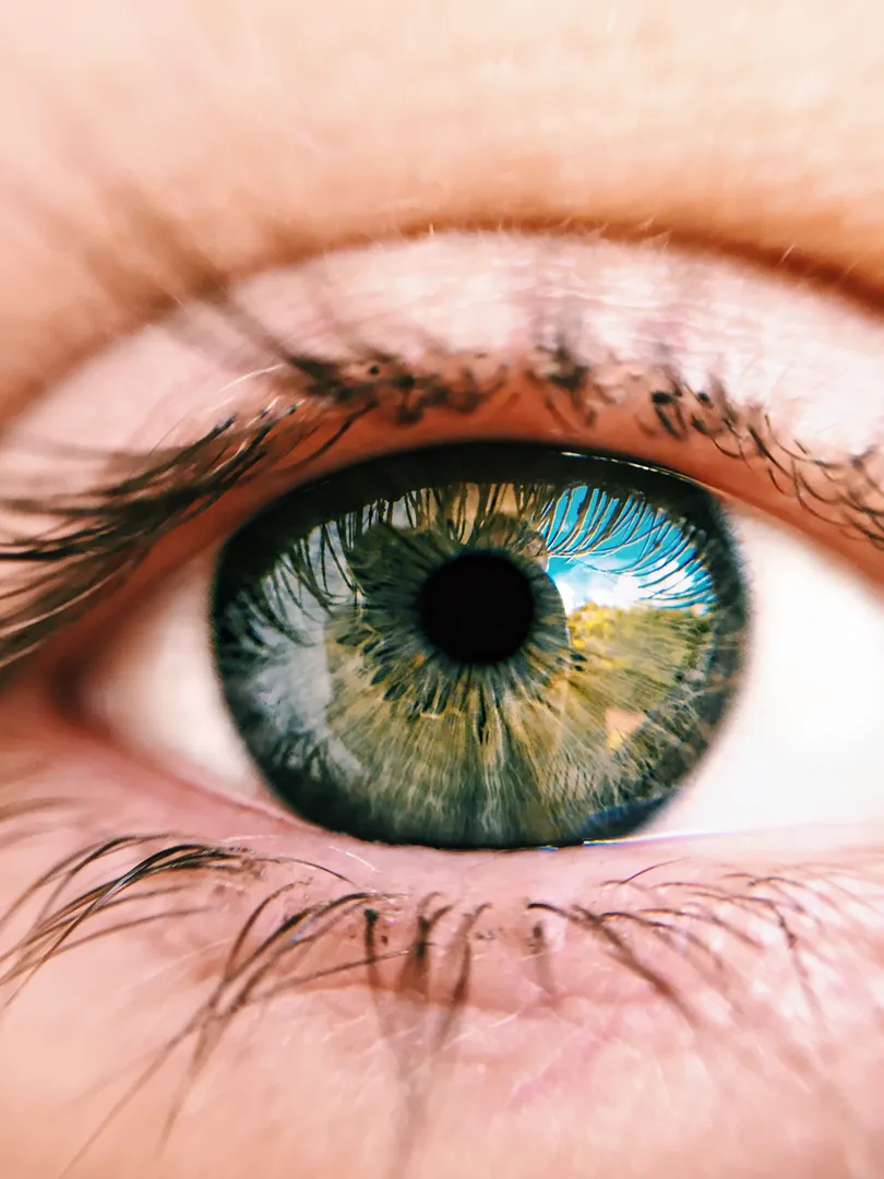 Would you consider undergoing eyeballs scanning to earn Worldcoin?

The coming together of Iridology and Worldcoin introduces possible challenges for humanity, evoking concerns related to privacy, exploitation, and the consolidation of power.

Disclaimer: This post is intended solely for educational and community engagement purposes. The information provided in this post is not meant to be construed as medical or financial advice. It should not be used as a substitute for professional medical or financial guidance. If you require medical or financial advice, please consult with a qualified and licensed professional. The author and platform assume no responsibility for any actions taken based on the information presented in this post. Always seek the advice of a professional before making any medical or financial decisions.

Leave your comments below. ⬇️⬇️⬇️

#AI #WorldCoin #EyeBallScan

https://www.linkedin.com/pulse/how-iridology-worldcoin-presents-potential-threats-jean-ng-web3-%25E1%25B5%258D%25E1%25B5%2590   
