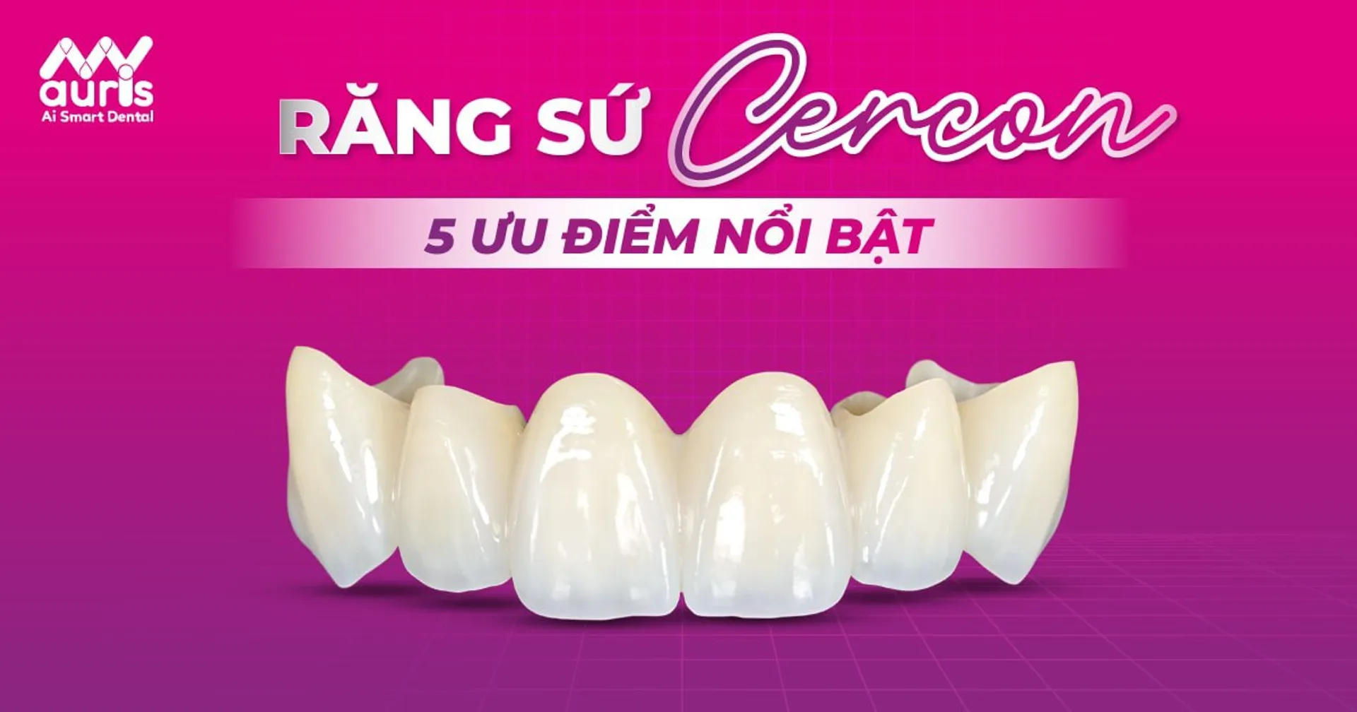 Các loại răng sứ Cercon và 5 ưu điểm nổi bật
https://myauris.vn/cac-loai-rang-su-cercon-va-5-uu-diem-noi-bat
Các loại răng sứ Cercon hiện có trong nha khoa là răng sứ Cercon Zirconia và răng sứ Cercon HT. Cả hai loại đều có khả năng phục hình và cải thiện thẩm mỹ tốt hiện nay.
