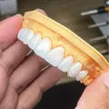 Chinese Dental Lab-Denture 