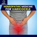 Best varicocele treatment